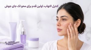 کنترل التهاب پوست و مراقبت از لکهای باقیمانده از جوش