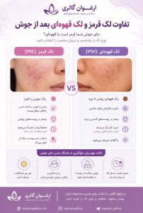 تفاوت لک قرمز و لک قهوهای بعد از جوش