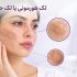 تفاوت لک هورمونی و لک جای جوش